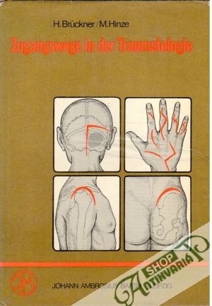 Obal knihy Zugangswege in der Traumatologie