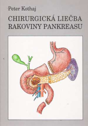 Obal knihy Chirurgická liečba rakoviny pankreasu