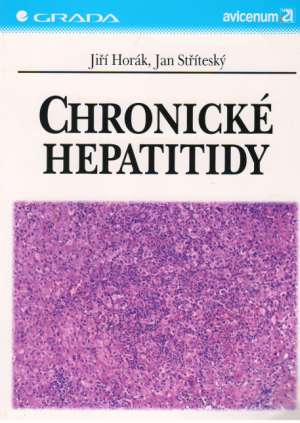 Obal knihy Chronické hepatitidy