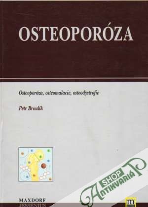 Obal knihy Osteoporóza