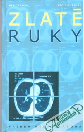 Zlaté ruky - Carson Ben, Murphey Cecil