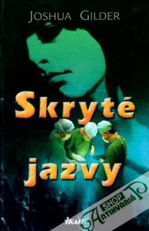 Obal knihy Skryté jazvy