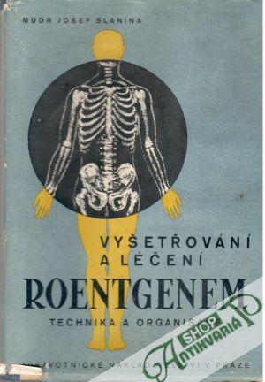 Vyšetřování a léčení roentgenem: Technika a organisace - Slanina Josef