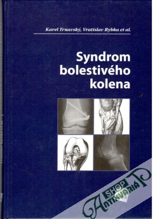 Obal knihy Syndrom bolestivého kolena