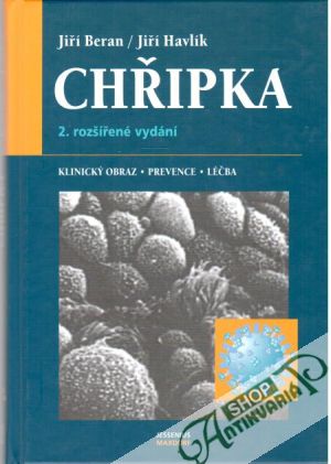 Obal knihy Chřipka 