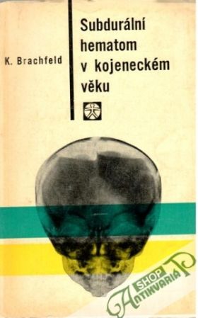Subdurální hematom v kojeneckém věku - Brachfeld Karel