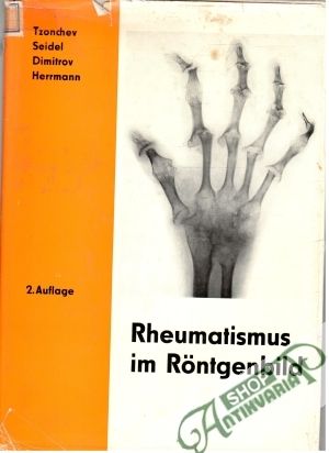 Rheumatismus im Röntgenbild - Tzonchev, Seidel, Dimitrov, Herrmann