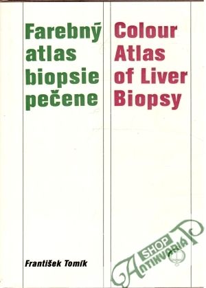 Obal knihy Farebný atlas biopsie pečene