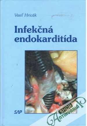 Obal knihy Infekčná endokarditída