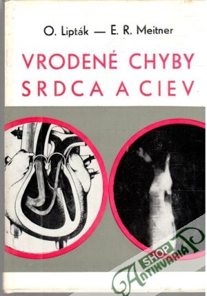 Vrodené chyby srdca a ciev - Lipták O., Meitner E.R.