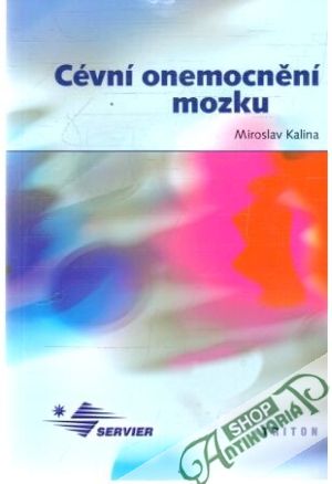 Cévní onemocnění mozku - Kalina Miroslav