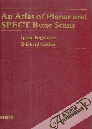 Obal knihy An atlas of planar and spect bone scans