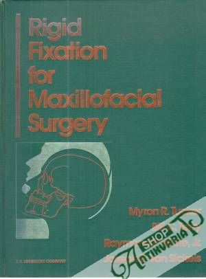 Obal knihy Rigid fixation for maxillofacial surgery