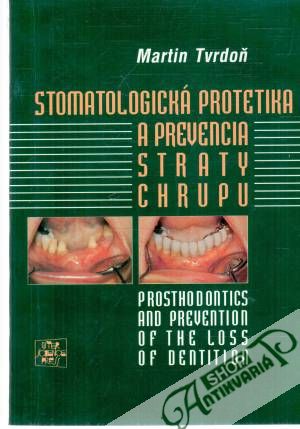 Stomatologická protetika a prevencia straty chrupu - Tvrdoň Martin