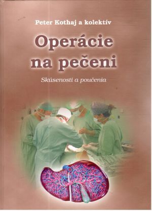 Obal knihy Operácie na pečeni