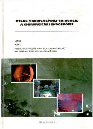 Obal knihy Atlas miniinvazívnej chirurgie a chirurgickej endoskopie
